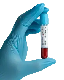 Pathology test
